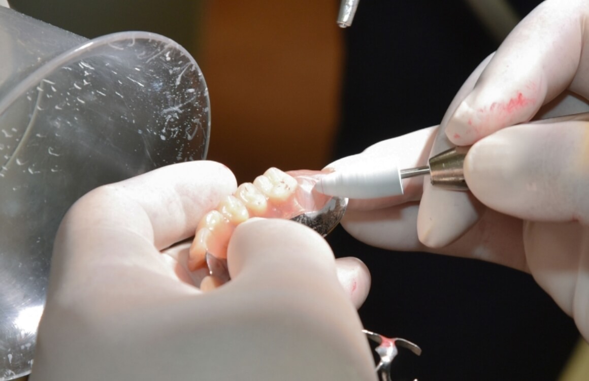一流の歯科技工士との連携イメージ