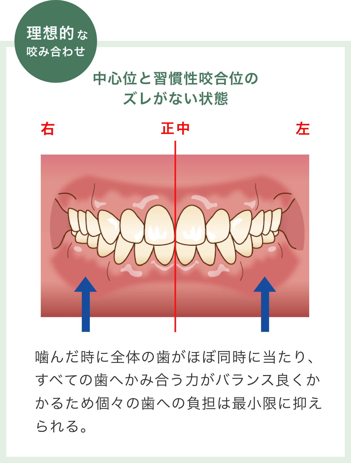 理想的なかみ合わせ