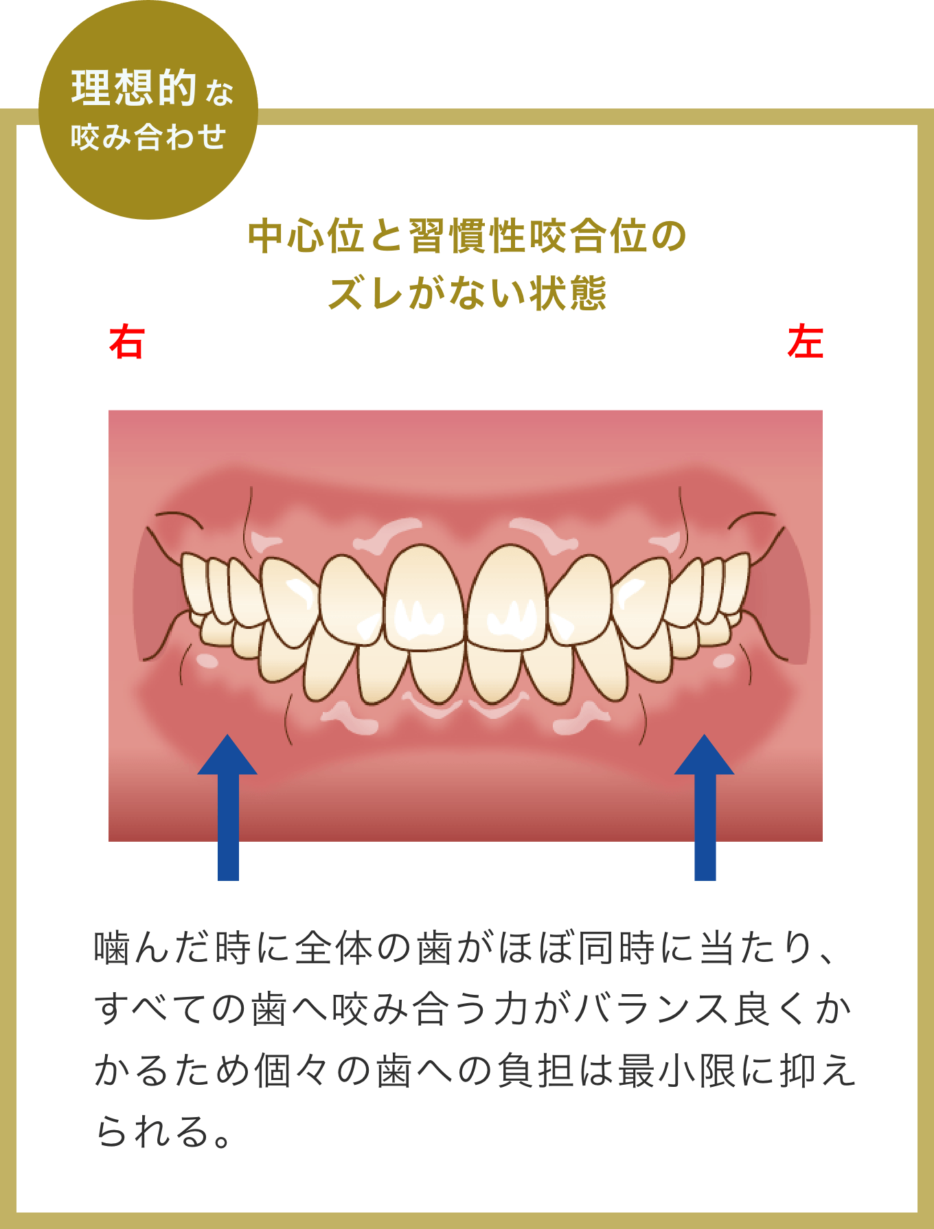 理想的な咬み合わせ/中心位と習慣性咬合位のズレがない状態
