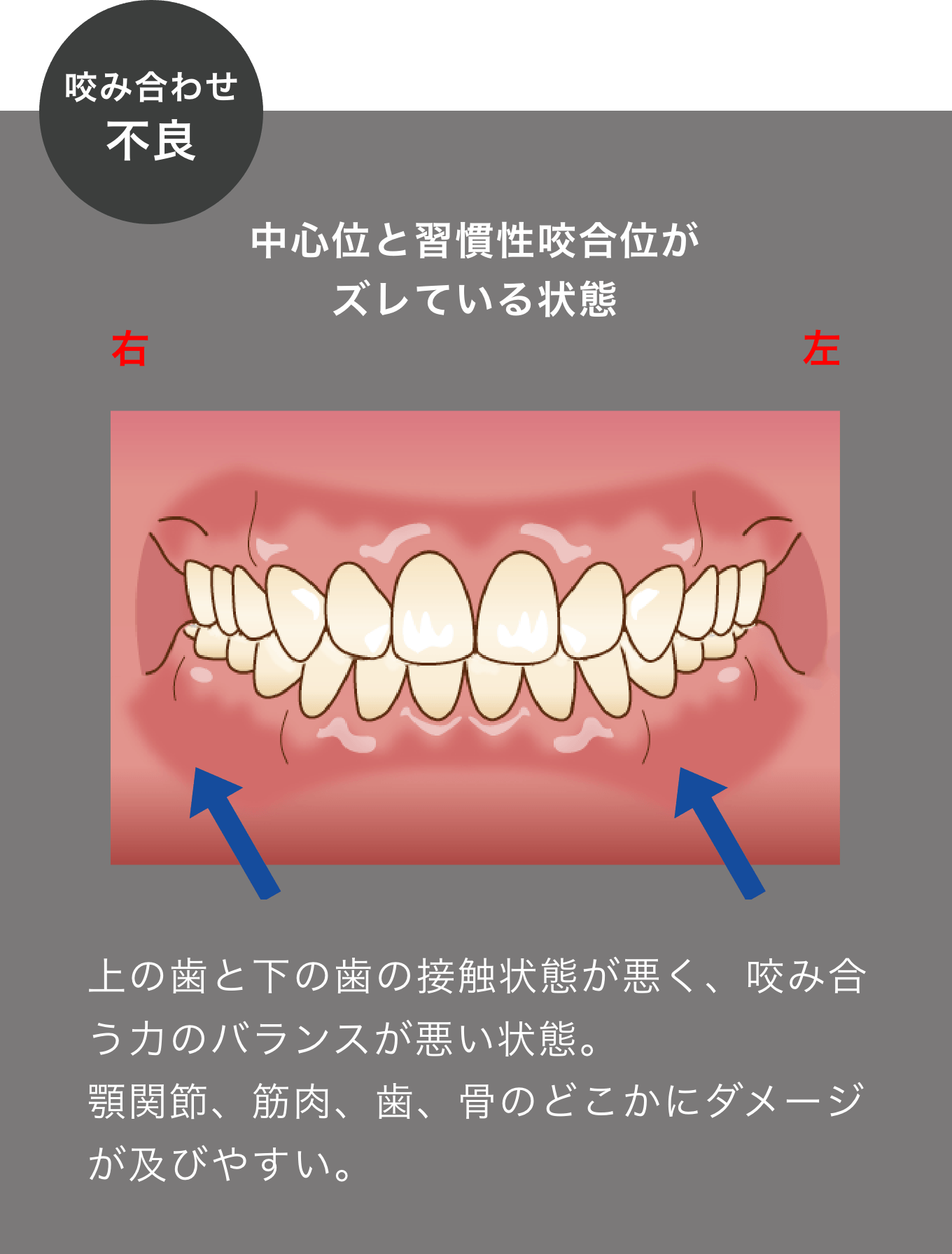 咬み合わせ認定医のハイクオリティな入れ歯｜難症例でもOK | たま